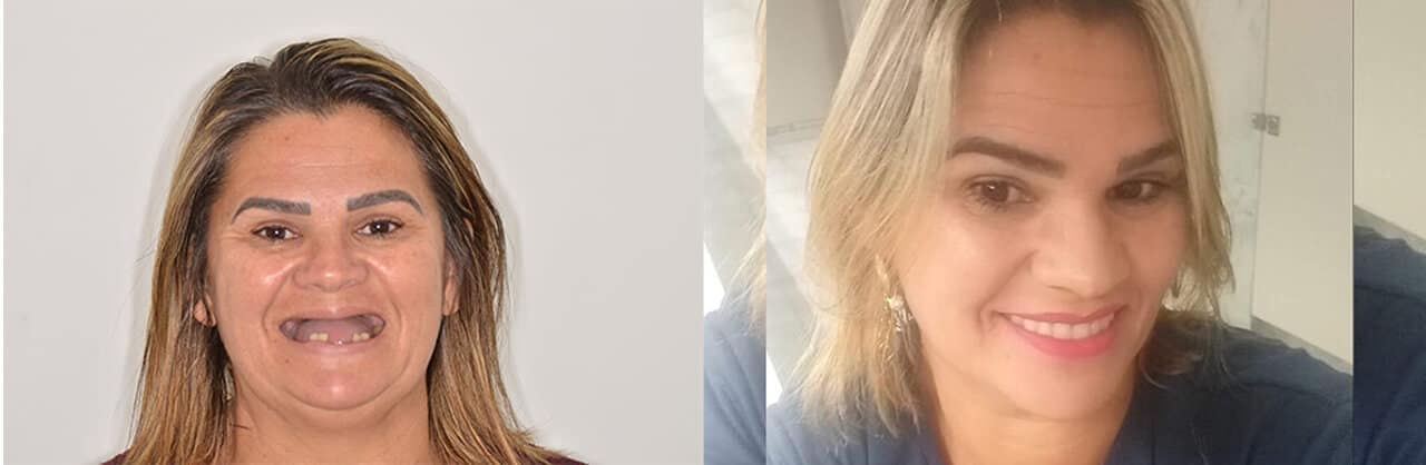 Voito Odontologia - tratamento odontológico - Clinica Dentista em Brasília Ceilândia